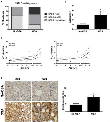 Intrahepatic Expression of Fatty Acid Translocase CD36 Is Increased in Obstructive Sleep Apnea